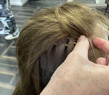 hair loss integration clinics Elgin, Moray