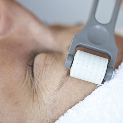 Collagen-Stimulation